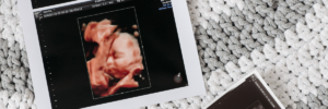 Ultrassom como apoio a medicina fetal.