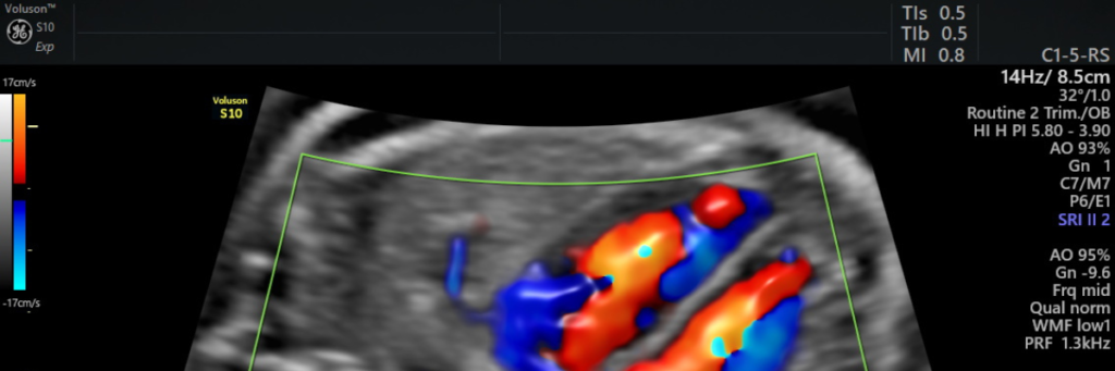 Ultrassom morfológico